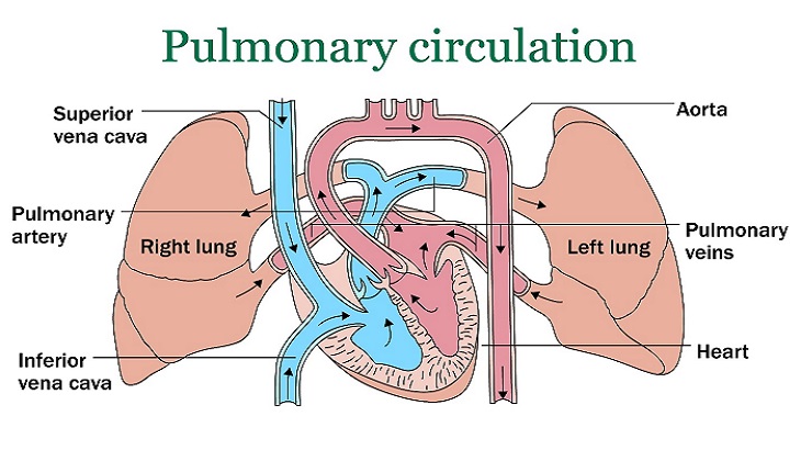 Pulmonary Hypertension – Causes, Symptoms, and Treatment